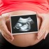 W karcie ciąży zapisuje się wszystkie badania, które kobieta przechodzi w trakcie ciąży oraz wizyty u specjalistów