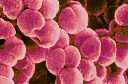 Meningokoki mogą wywołać m.in.zapalenie gardła czy ucha środkowego. Na ilustracji obraz bakterii pod mikroskopem.  