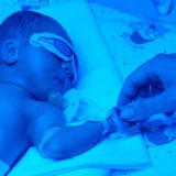 Żeby żółtaczka fizjologiczna szybciej minęła, noworodek jest naświetlany w inkubatorze specjalnymi lampami.     