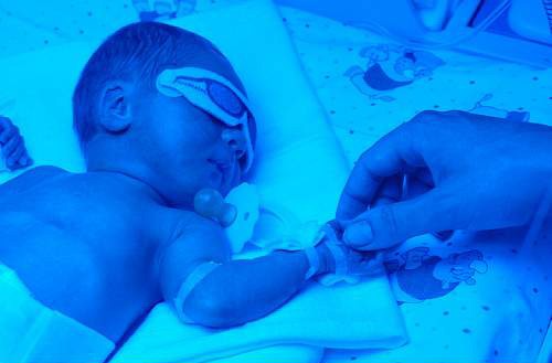 Żeby żółtaczka fizjologiczna szybciej minęła, noworodek jest naświetlany w inkubatorze specjalnymi lampami.     