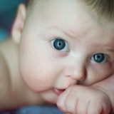 W wieku niemowlęcym rogowacenie skóry objawia się rzadko. Rogowacenie skóry najczęściej występuje u dzieci między pierwszym a piątym rokiem życia i może współistnieć z AZS.   