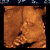 22 tydzień ciąży. Dziecko potrafi prosto trzymać głowę – to zasługa coraz mocniejszych mięśni karku. Wykształcają się małżowiny uszne (nikt na całym świecie nie ma takich samych)