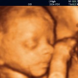 26 tydzień ciąży. Dziecko waży 900 gram – od teraz zacznie w większym stopniu powiększać się tkanka tłuszczowa, dzięki której za 12-14 tygodni na świat przyjdzie okrągły bobasek. 