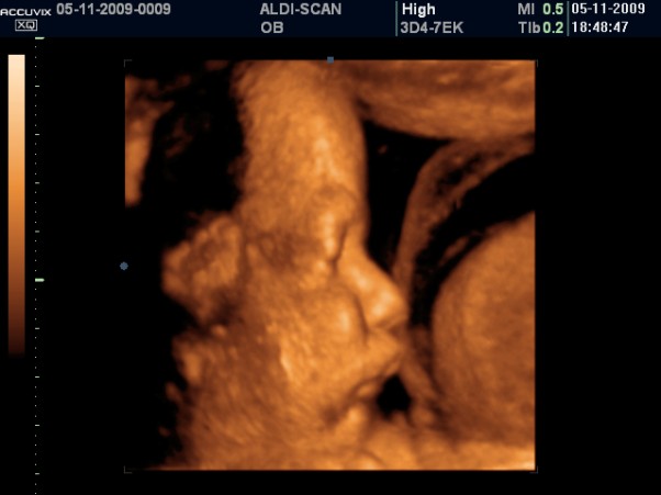 32 tydzień ciąży. Dziecko słyszy, jak bije twoje serce. Ten dźwięk je uspokaja. 