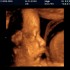 32 tydzień ciąży. Dziecko słyszy, jak bije twoje serce. Ten dźwięk je uspokaja. 