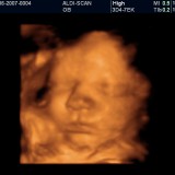 33 tydzień ciąży. Podczas badania USG zobaczysz, w jakiej pozycji znajduje się twoje dziecko. Jeśli nie ułożyło się główką do dołu, lekarz będzie się zastanawiał zapewne nad cięciem cesarskim.