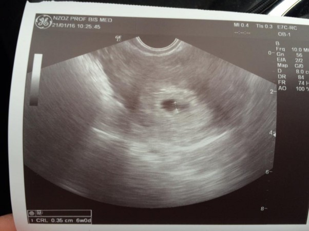 prepare_56a0c1d7b91ee5.45023617-big.jpg?_v=1527153336