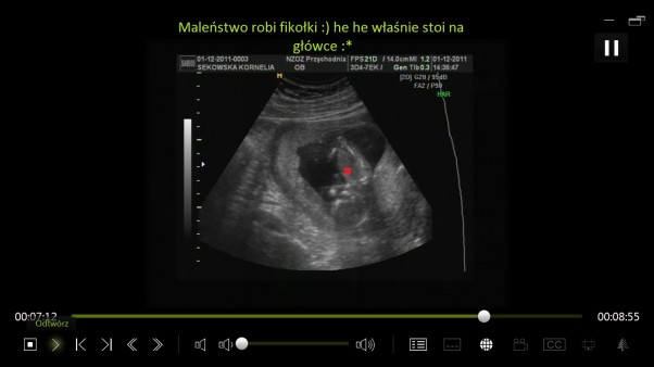 nasze Maleństwo :* robi fikołki :&#41;