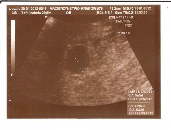 Kuleczka zdjęcie 1  5 tydzień ciąży