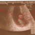 zdjęcie opisane &#45; 7 tydzień ciąży
