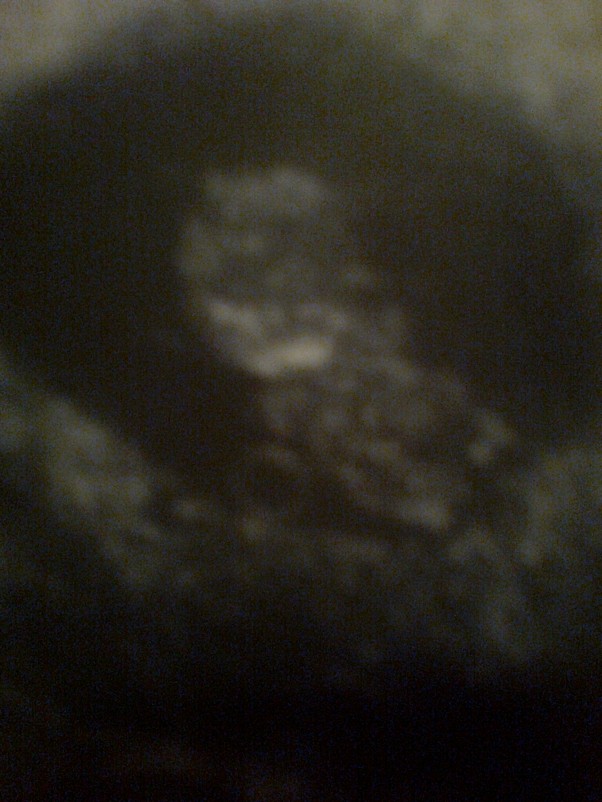 Kuleczka zdjęcie 3 9 tydzień ciąży &#45; jestem już małym człowieczkiem